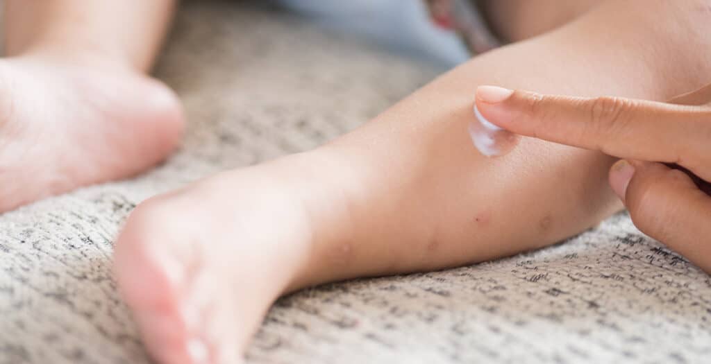 Protégez votre bébé des moustiques : nos conseils et astuces